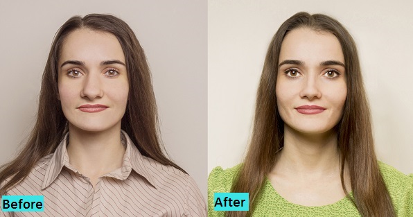 best-rhinoplasty-surgery-treatment-in-pune-india